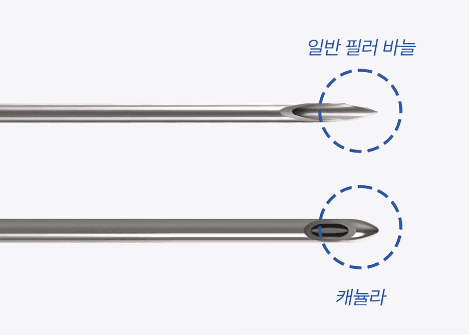 캐뉼라 시술 원리