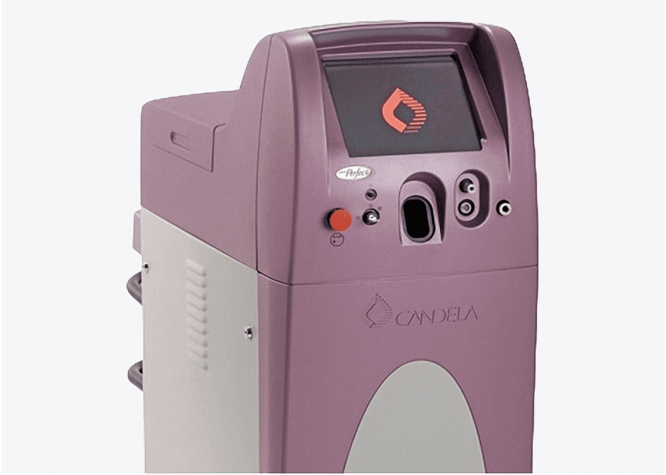 V-beam Perfecta