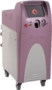 V-beam Perfecta